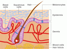 A Natural Skin Cancer Cure - Iodine!