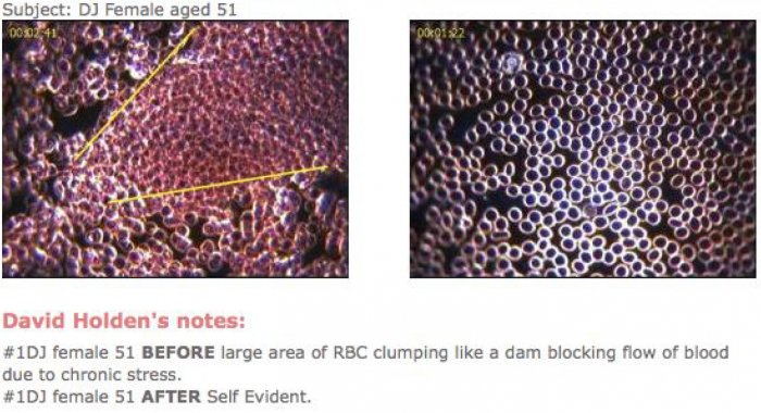 blood quantum calculator